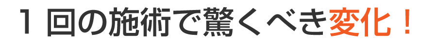 舟入 巻き爪,舟入 陥入爪