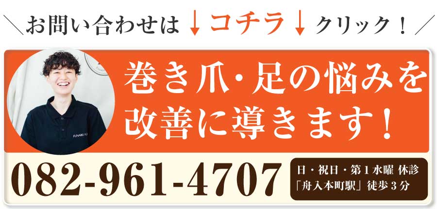 舟入 巻き爪,舟入 陥入爪